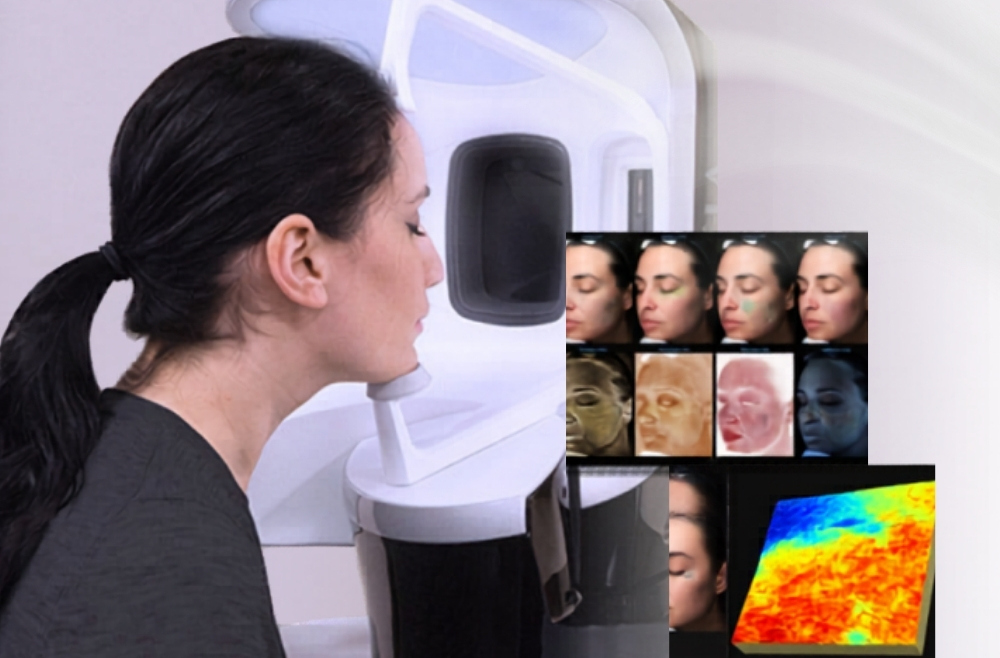 Ce este analiza VISIA și de ce o faci înainte de orice tratament