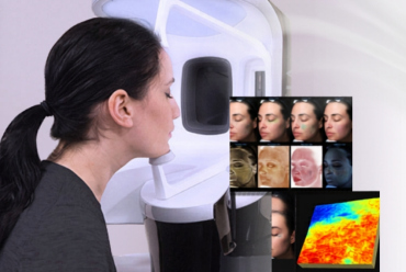 Ce este analiza VISIA și de ce o faci înainte de orice tratament